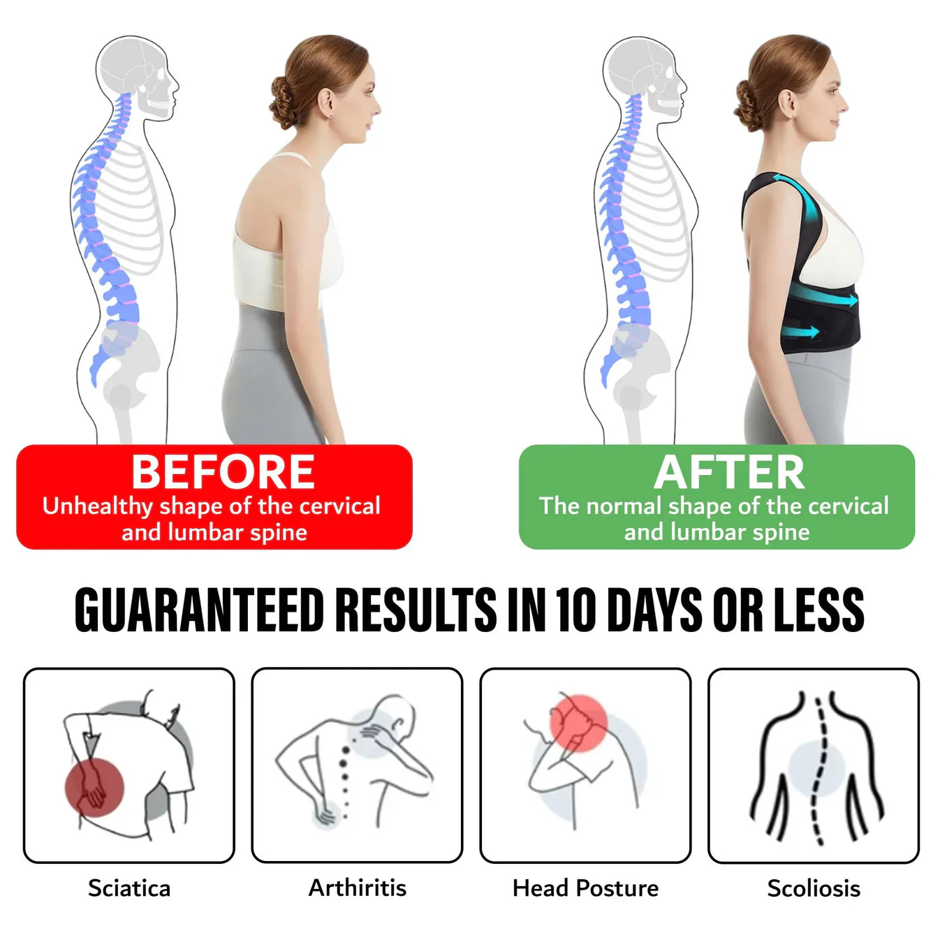 Posture Pro | Corrects your Posture and Relieves Back Pain